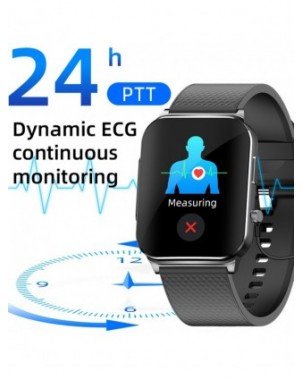 Išmanioji elektronika-Išmanieji laikrodžiai-Neinvazinis gliukozės kiekio kraujyje EKG PTT
