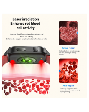 Smart Electronics-Smart Watches-Painless Non-invasive Blood