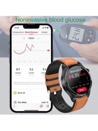 Išmanioji elektronika-Išmanieji laikrodžiai-2023 m. naujas EKG+PPG neinvazinis gliukozės kiekio