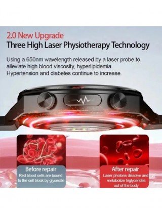 New Laser Treatment Three High Smart Watch Men ECG PPG Heart