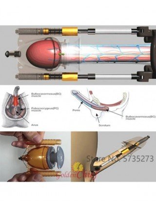 Varpos ilgintuvas Stetcher Master didinimo prietaisas Dick Pump