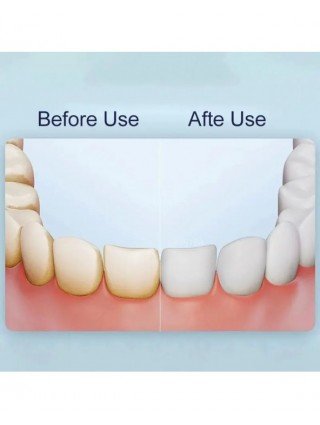 XIAOMI MIJIA Electric Oral Irrigator F300 Portable Water Pick