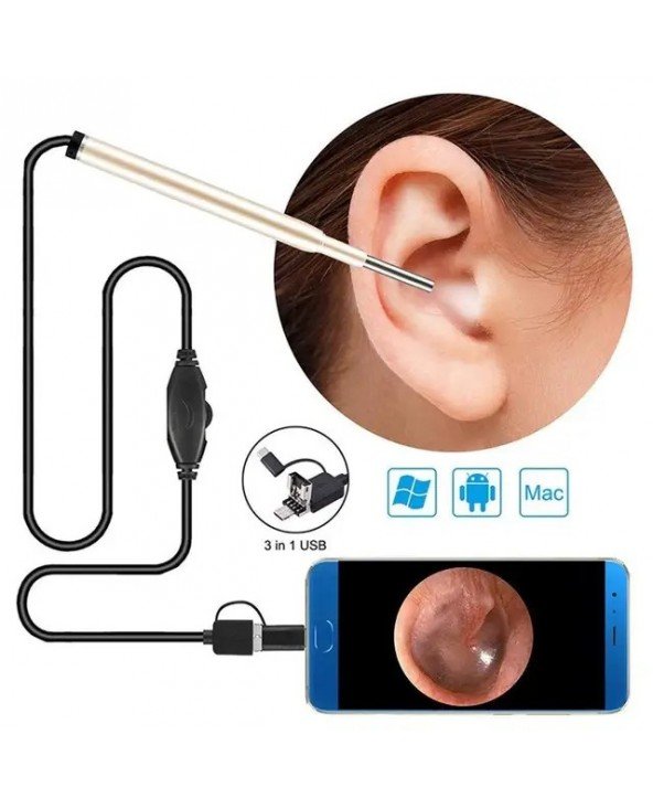 3.9mm Otoscope Ear Inspection Camera Video 3 in 1 USB Visual 3.9mm Otoscope Ear Inspection Camera Video 3 in 1 USB Visual